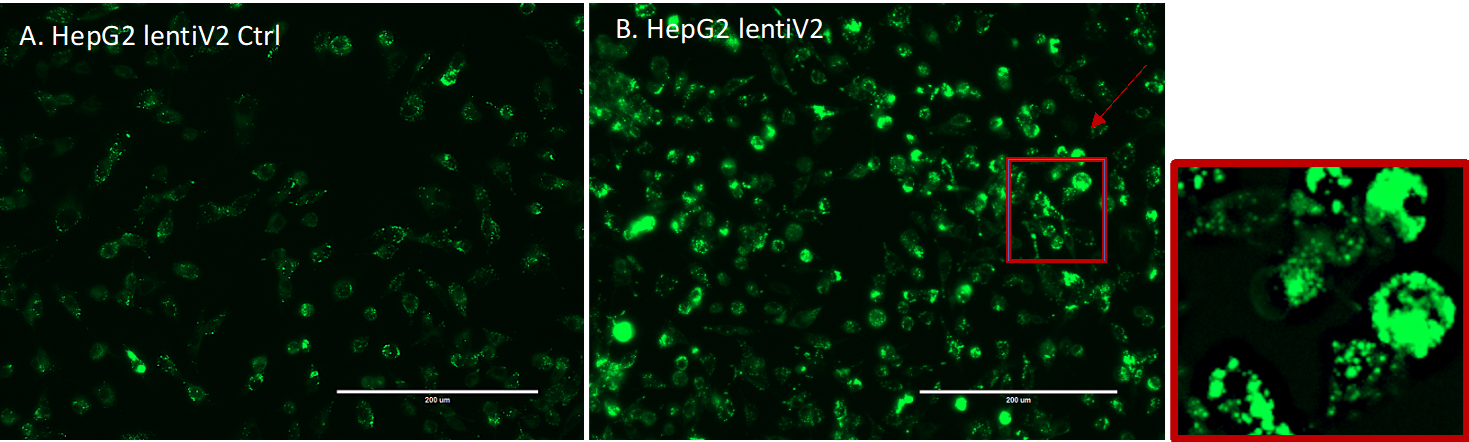 Figure S8: EVOS Fluorescence Microscope Image Capture. A. HepG2_lentiV2_Ctrl with no-viral transduction. B. HepG2_lentiV2 with viral transduction. Both no-viral transduction Control (A) and lentiviral transduction (B) HepG2 cells were stained with LipidSpot™488. The CRISPR screening process was performed once, but we conducted two selections (high and low fluorescence) with a control of no/before selection. Subsequently, we generated three technical replicates for the DNA-seq libraries under each condition. In order to mitigate false positives resulting from the single-screen process, we overlapped the candidates from multiple pairwise differential analyses and selected the genes that were consistent between selections.