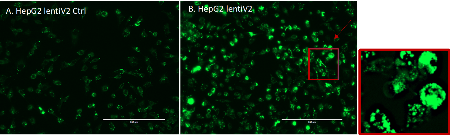 Figure 8: EVOS Fluorescent Microscope Image Capture. A. HepG2_lentiV2_Ctrl with no-viral transduction. B. HepG2_lentiV2 with viral transduction. 
